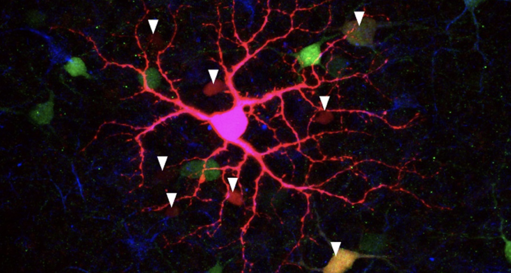 babies-in-the-womb-may-see-more-than-we-thought-uc-berkeley-vision